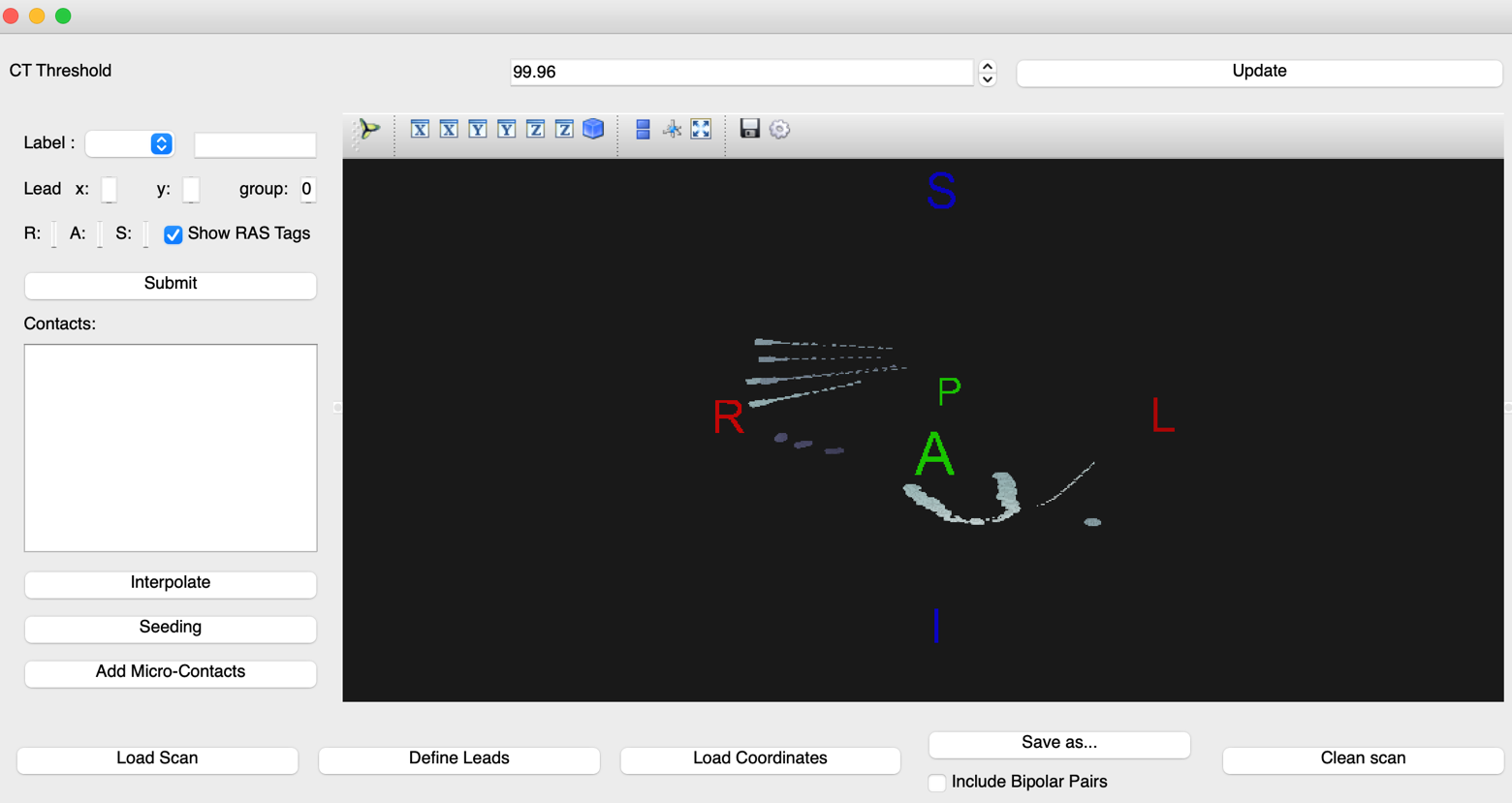 voxTool empty CT electrode viewer window