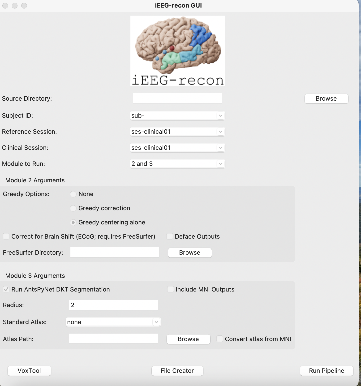 iEEG-recon GUI, duplicate of empty-field screenshot
