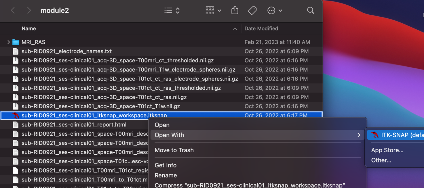 Finder module2 listing for sub-RID0921 with Open With ITK-SNAP context menu