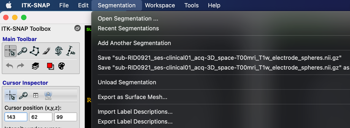 ITK-SNAP Segmentation menu with sub-RID0921 filename