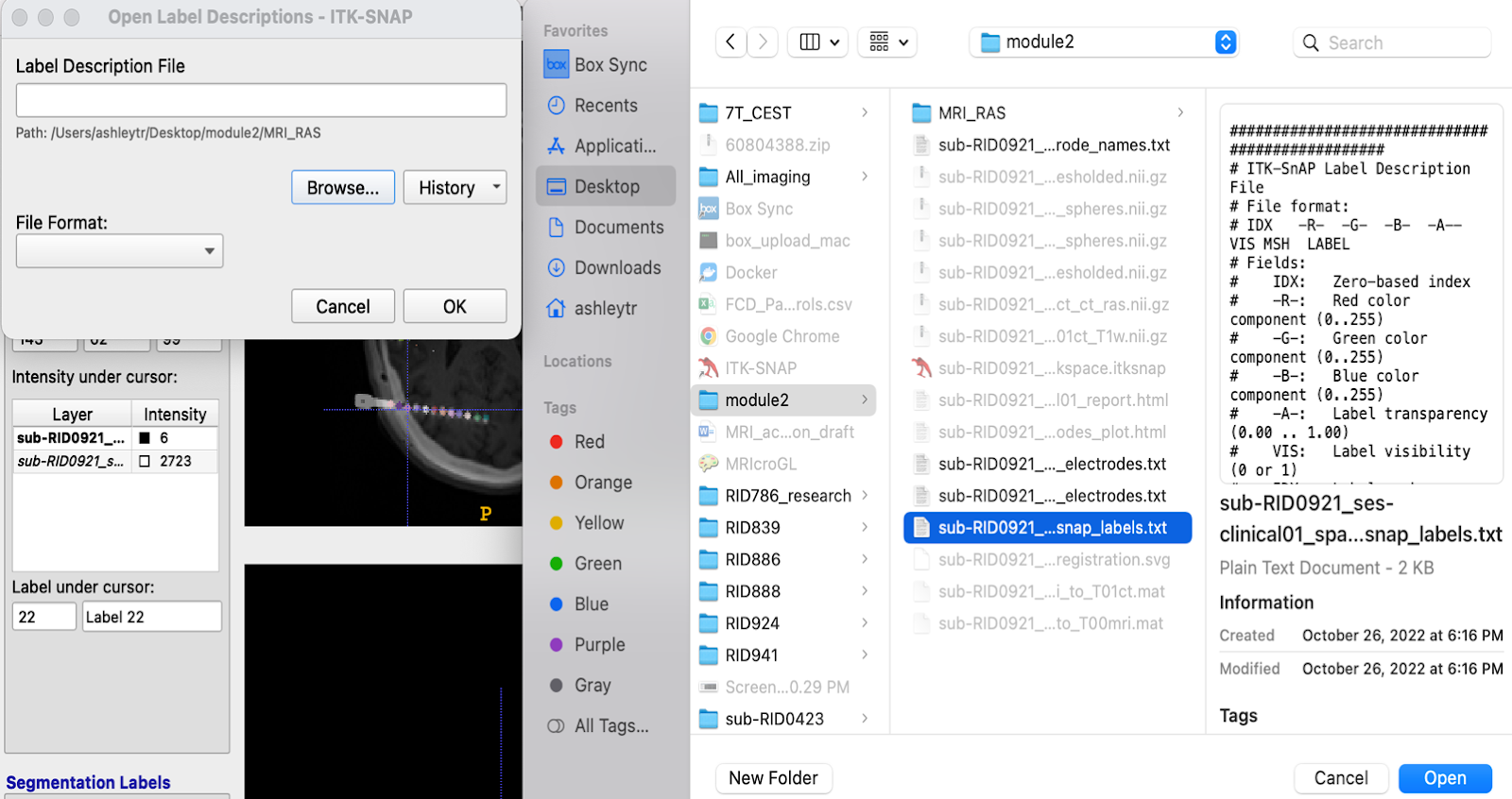 ITK-SNAP open label file dialog; Finder sidebar shows RID folders; small axial slice